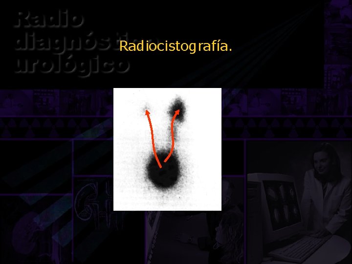 Radiocistografía. 