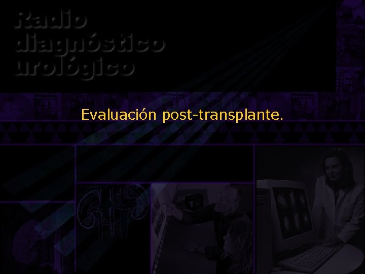 Evaluación post-transplante. 