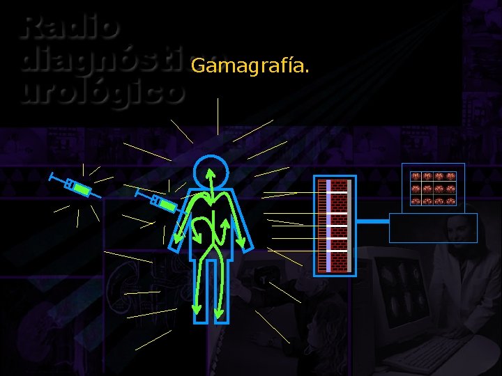 Gamagrafía. 