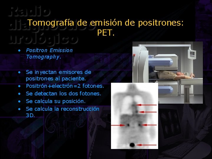 Tomografía de emisión de positrones: PET. • Positron Emission Tomography. • Se inyectan emisores
