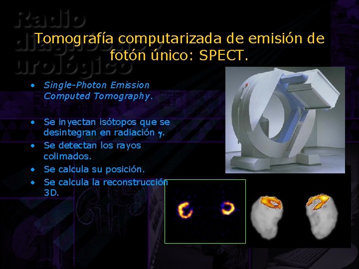 Tomografía computarizada de emisión de fotón único: SPECT. • Single-Photon Emission Computed Tomography. •