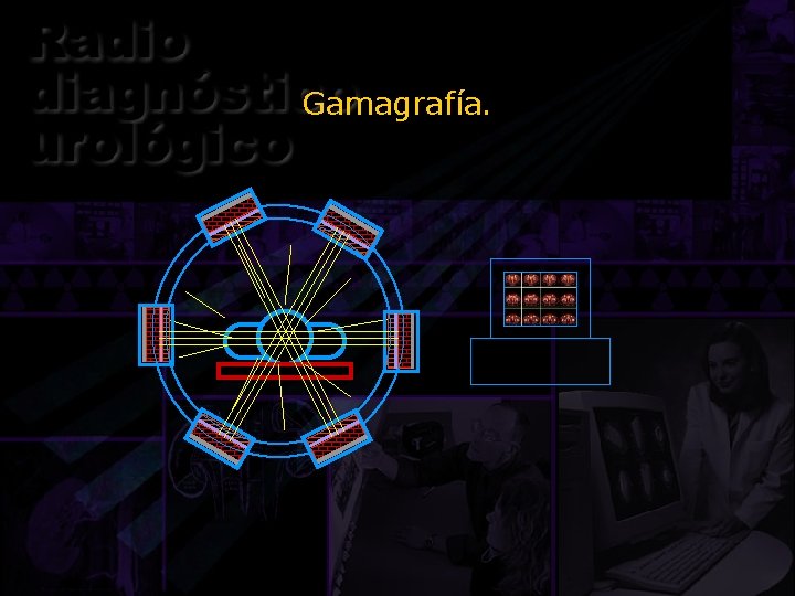 Gamagrafía. 