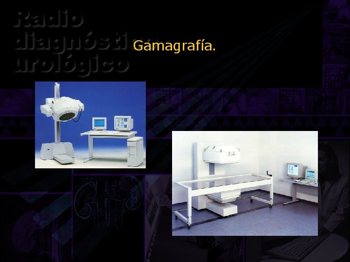 Gamagrafía. 