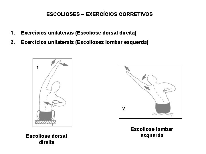 ESCOLIOSES – EXERCÍCIOS CORRETIVOS 1. Exercícios unilaterais (Escoliose dorsal direita) 2. Exercícios unilaterais (Escolioses