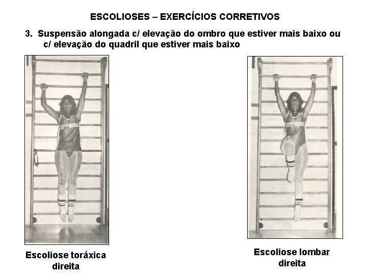 ESCOLIOSES – EXERCÍCIOS CORRETIVOS 3. Suspensão alongada c/ elevação do ombro que estiver mais