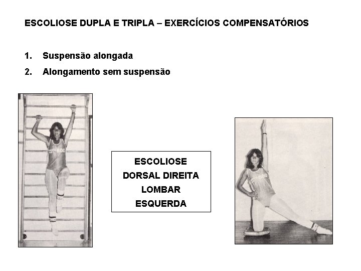 ESCOLIOSE DUPLA E TRIPLA – EXERCÍCIOS COMPENSATÓRIOS 1. Suspensão alongada 2. Alongamento sem suspensão