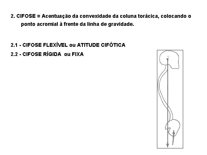 2. CIFOSE = Acentuação da convexidade da coluna torácica, colocando o ponto acromial à