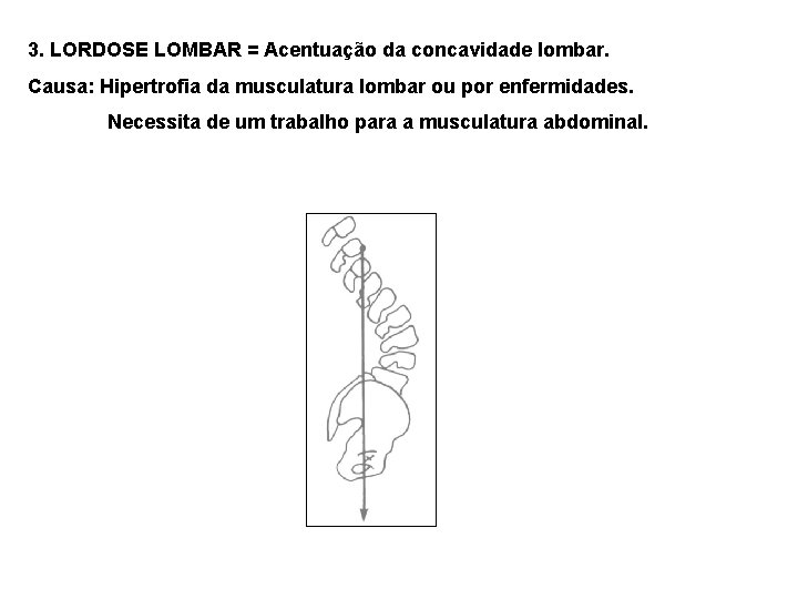 3. LORDOSE LOMBAR = Acentuação da concavidade lombar. Causa: Hipertrofia da musculatura lombar ou