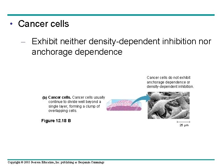  • Cancer cells – Exhibit neither density-dependent inhibition nor anchorage dependence Cancer cells