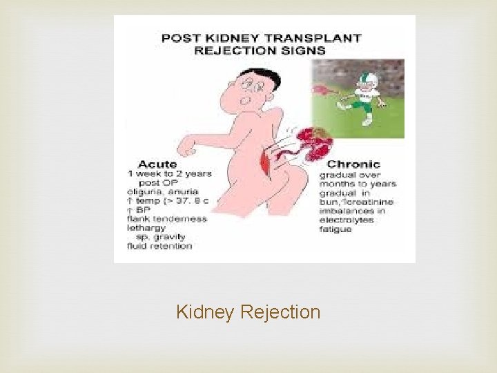 Kidney Rejection 