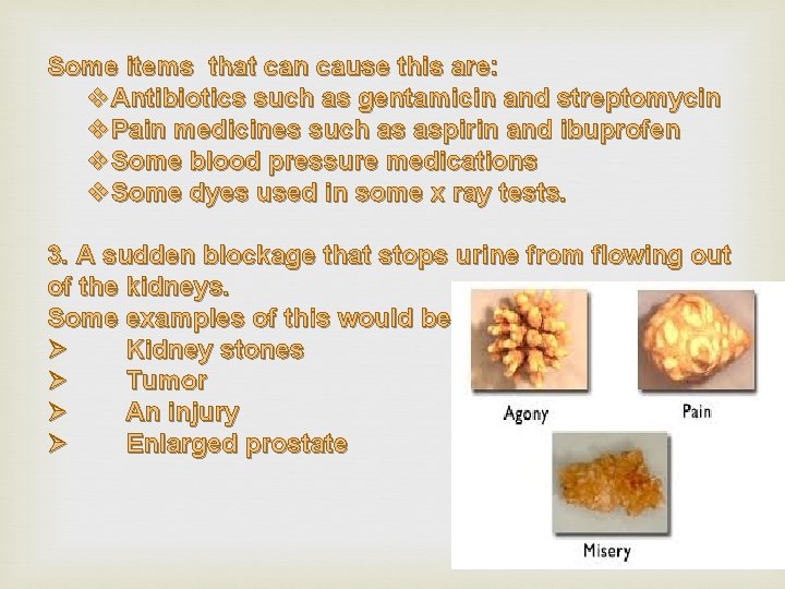 Some items that can cause this are: v. Antibiotics such as gentamicin and streptomycin