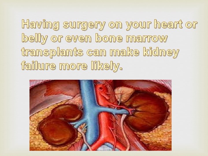 Having surgery on your heart or belly or even bone marrow transplants can make