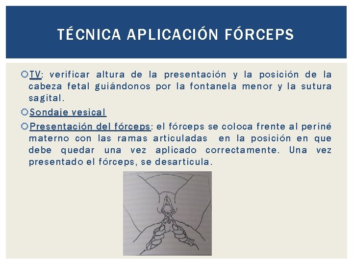 TÉCNICA APLICACIÓN FÓRCEPS TV: TV verificar altura de la presentación y la posición de