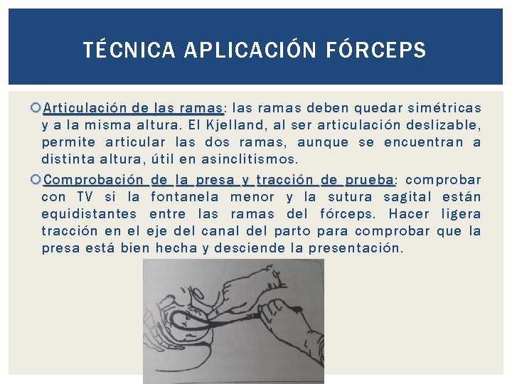 TÉCNICA APLICACIÓN FÓRCEPS Articulación de las ramas: ramas las ramas deben quedar simétricas y