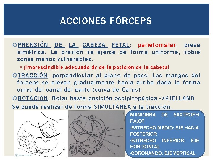 ACCIONES FÓRCEPS PRENSIÓN DE LA CABEZA FETAL: FETAL parietomalar, presa simétrica. La presión se