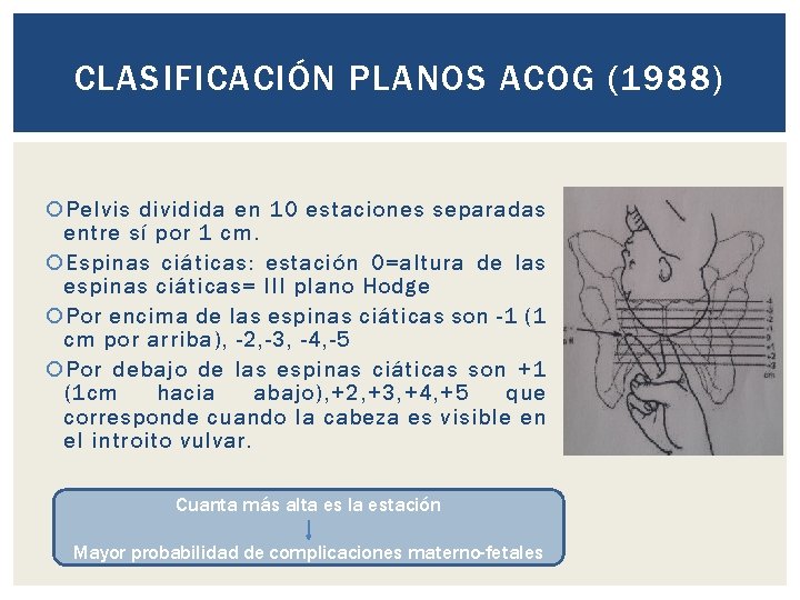 CLASIFICACIÓN PLANOS ACOG (1988) Pelvis dividida en 10 estaciones separadas entre sí por 1
