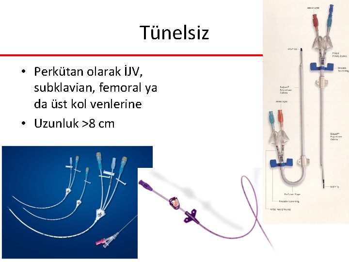 Tünelsiz • Perkütan olarak İJV, subklavian, femoral ya da üst kol venlerine • Uzunluk Tünelsiz • Perkütan olarak İJV, subklavian, femoral ya da üst kol venlerine • Uzunluk