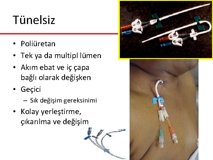 Tünelsiz • Poliüretan • Tek ya da multipl lümen • Akım ebat ve iç Tünelsiz • Poliüretan • Tek ya da multipl lümen • Akım ebat ve iç
