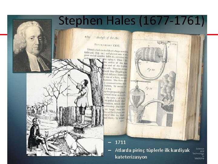 Stephen Hales (1677 -1761) – 1711 – Atlarda pirinç tüplerle ilk kardiyak kateterizasyon Stephen Hales (1677 -1761) – 1711 – Atlarda pirinç tüplerle ilk kardiyak kateterizasyon