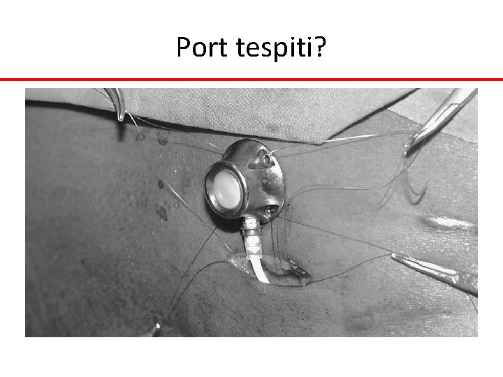 Port tespiti? Port tespiti?