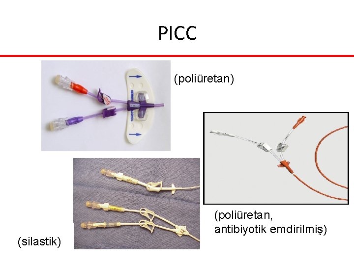PICC (poliüretan) (silastik) (poliüretan, antibiyotik emdirilmiş) PICC (poliüretan) (silastik) (poliüretan, antibiyotik emdirilmiş)