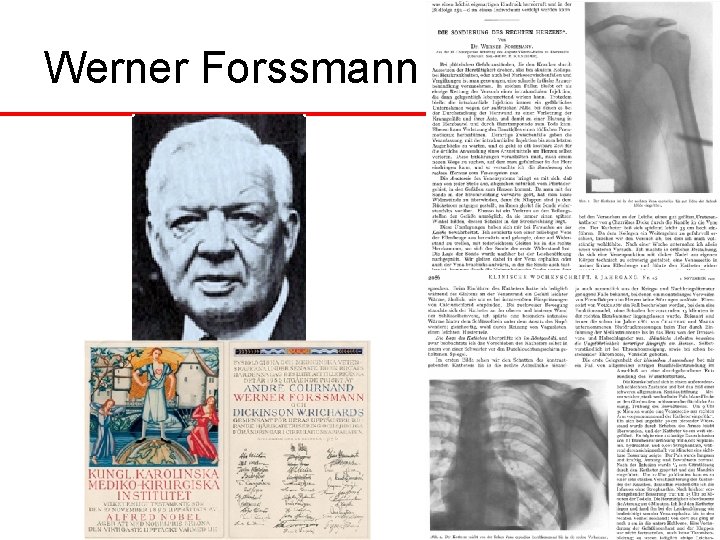 Werner Forssmann Werner Forssmann