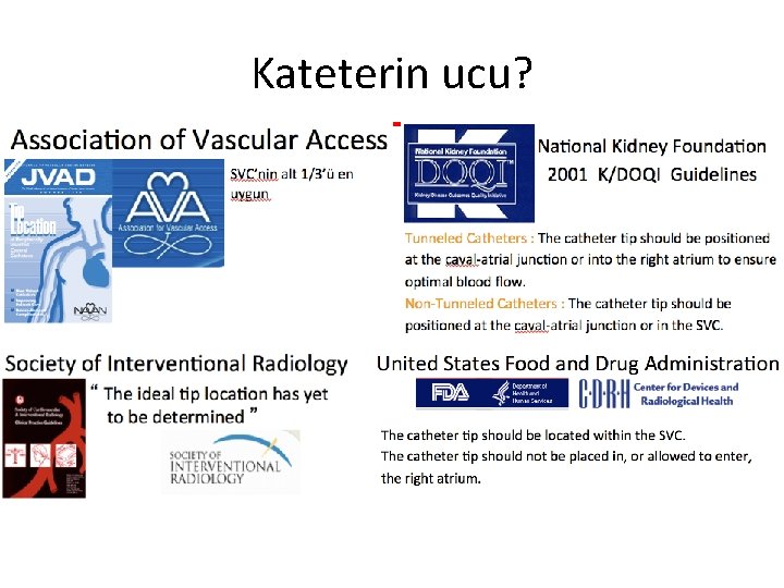 Kateterin ucu? Kateterin ucu?