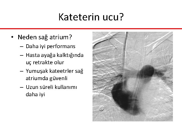 Kateterin ucu? • Neden sağ atrium? – Daha iyi performans – Hasta ayağa kalktığında Kateterin ucu? • Neden sağ atrium? – Daha iyi performans – Hasta ayağa kalktığında