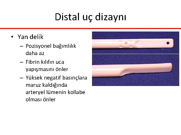 Distal uç dizaynı • Yan delik – Pozisyonel bağımlılık daha az – Fibrin kılıfın Distal uç dizaynı • Yan delik – Pozisyonel bağımlılık daha az – Fibrin kılıfın