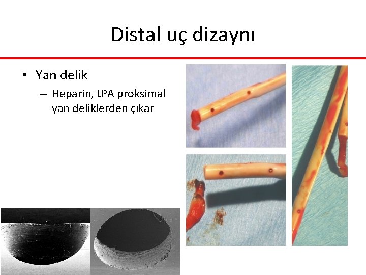 Distal uç dizaynı • Yan delik – Heparin, t. PA proksimal yan deliklerden çıkar Distal uç dizaynı • Yan delik – Heparin, t. PA proksimal yan deliklerden çıkar