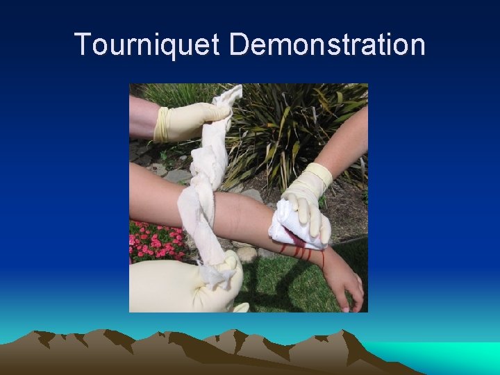 Tourniquet Demonstration 