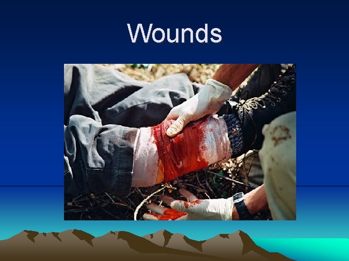 Wounds 