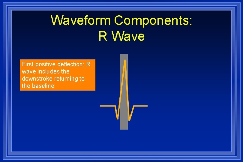 Waveform Components: R Wave First positive deflection; R wave includes the downstroke returning to
