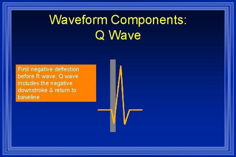 Waveform Components: Q Wave First negative deflection before R wave; Q wave includes the