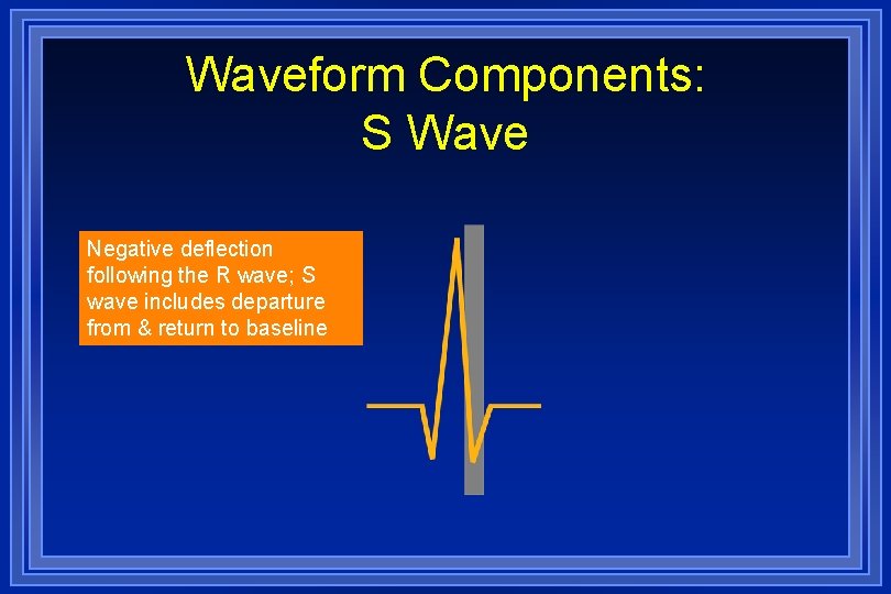 Waveform Components: S Wave Negative deflection following the R wave; S wave includes departure