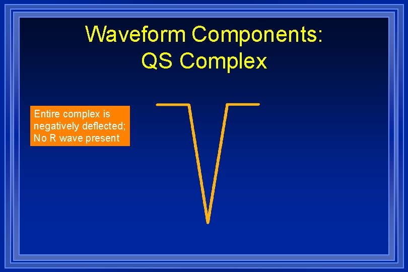Waveform Components: QS Complex Entire complex is negatively deflected; No R wave present 