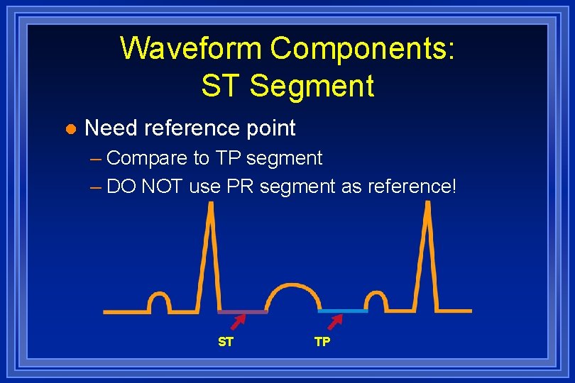 Waveform Components: ST Segment l Need reference point – Compare to TP segment –