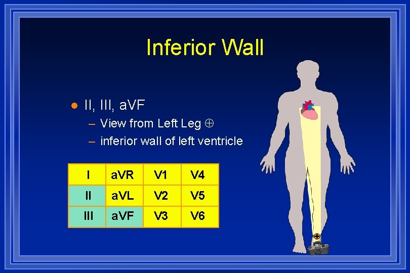 Inferior Wall l II, III, a. VF – View from Left Leg – inferior