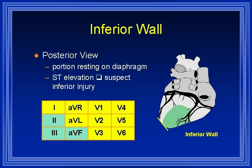 Inferior Wall l Posterior View – portion resting on diaphragm – ST elevation suspect