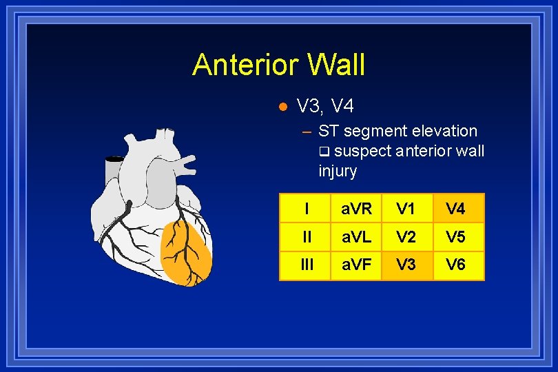 Anterior Wall l V 3, V 4 – ST segment elevation suspect anterior wall