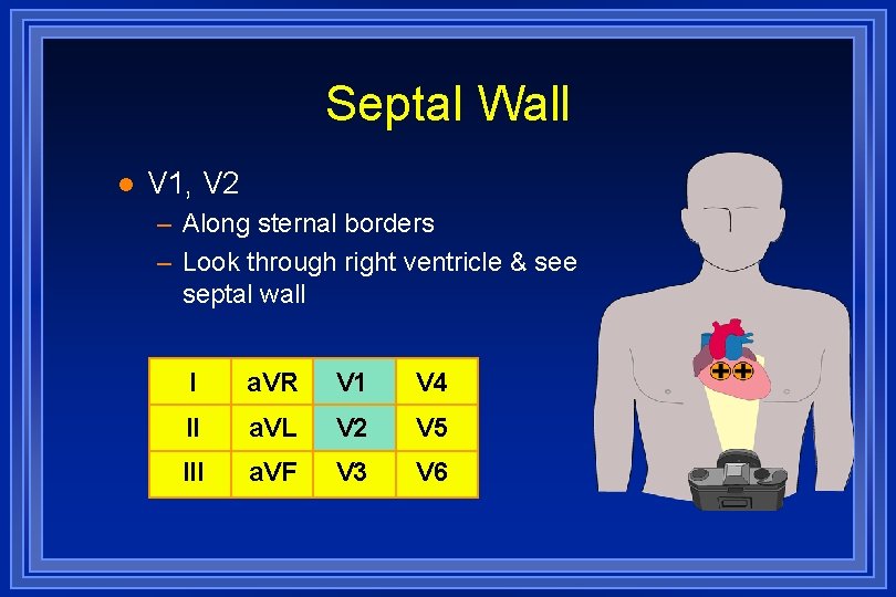 Septal Wall l V 1, V 2 – Along sternal borders – Look through