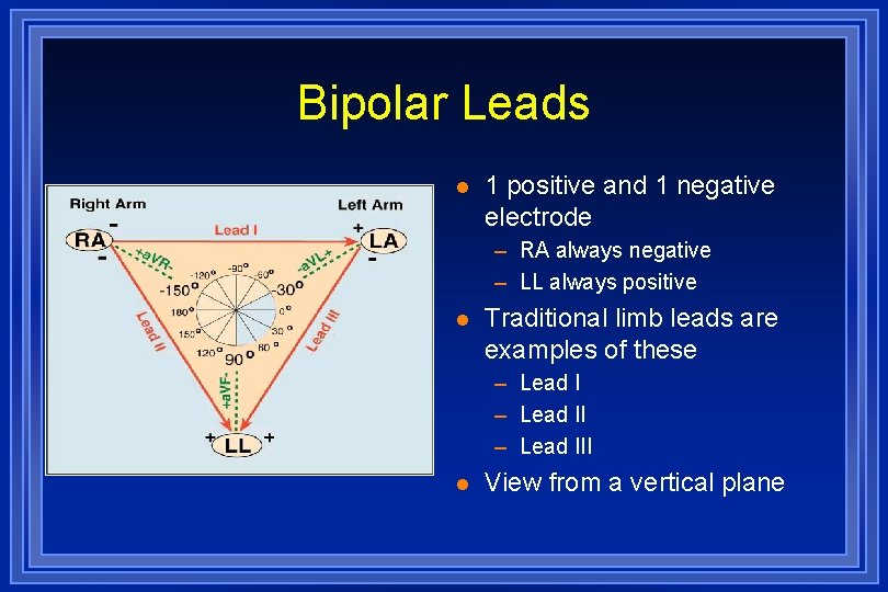 Bipolar Leads l 1 positive and 1 negative electrode – RA always negative – Bipolar Leads l 1 positive and 1 negative electrode – RA always negative –