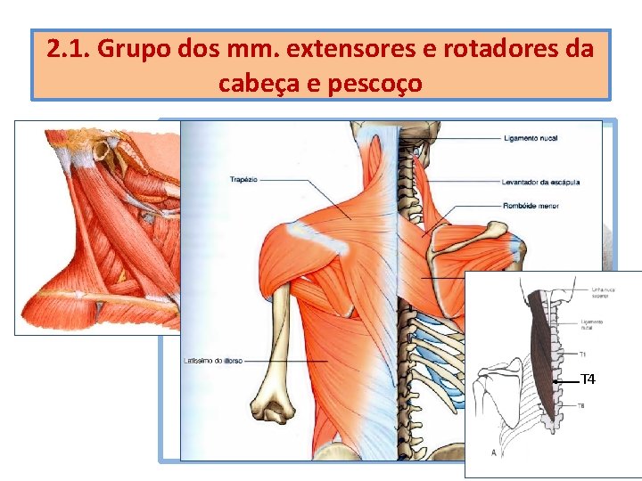 2. 1. Grupo dos mm. extensores e rotadores da cabeça e pescoço Esplênio da