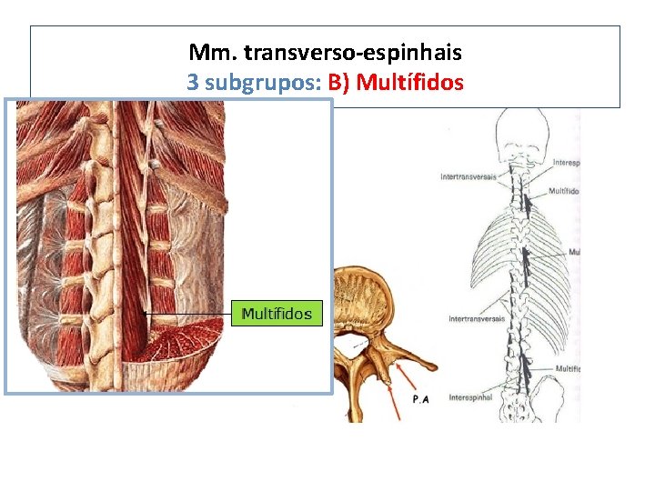 Mm. transverso-espinhais 3 subgrupos: B) Multífidos 