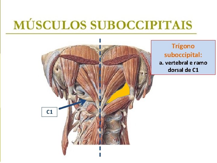 Trígono suboccipital: a. vertebral e ramo dorsal de C 1 