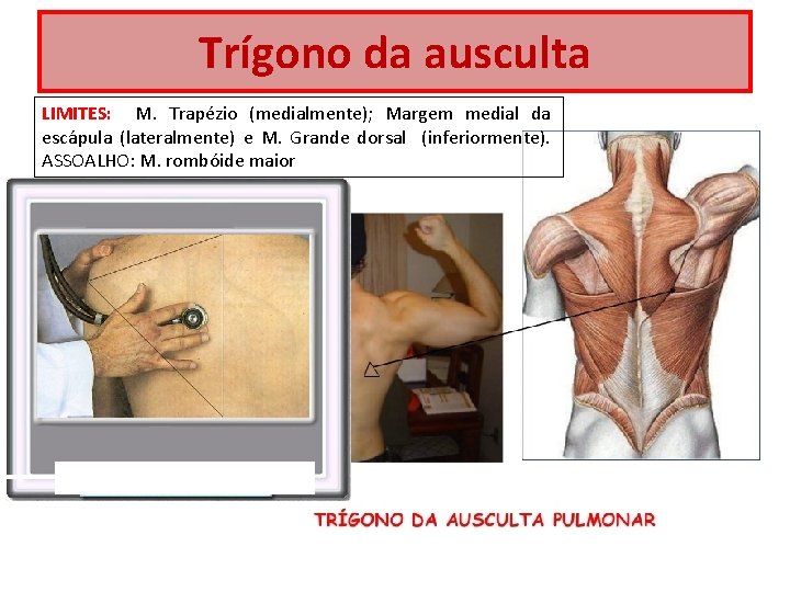 Trígono da ausculta LIMITES: M. Trapézio (medialmente); Margem medial da escápula (lateralmente) e M.