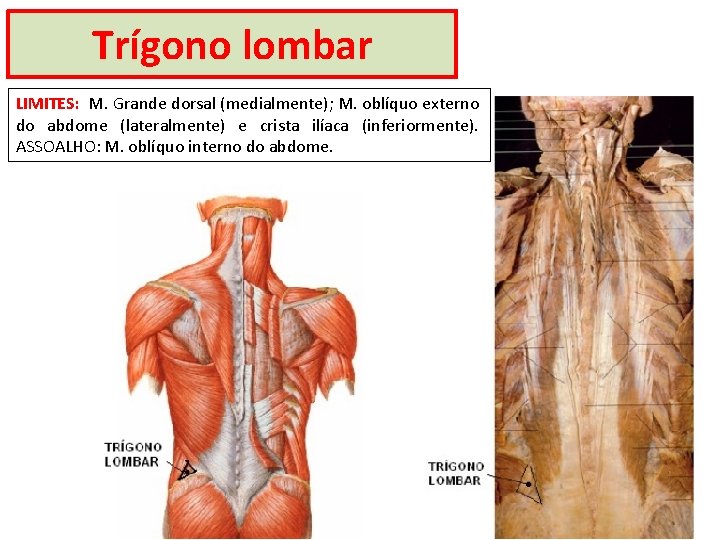 Trígono lombar LIMITES: M. Grande dorsal (medialmente); M. oblíquo externo do abdome (lateralmente) e