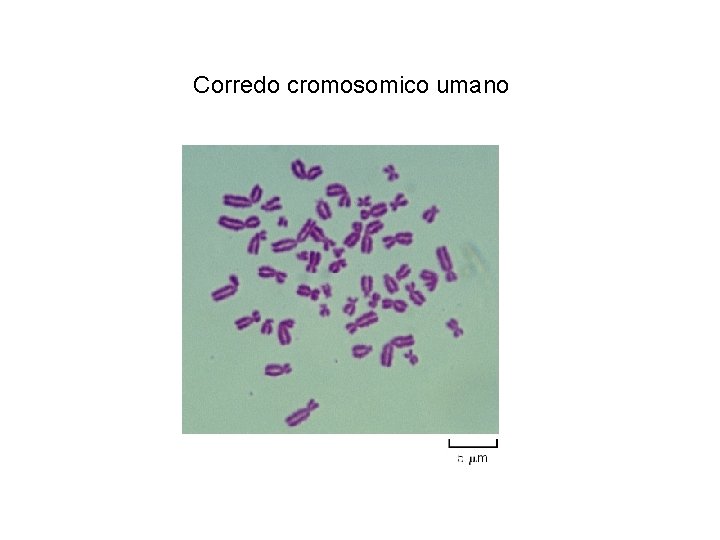 Corredo cromosomico umano 