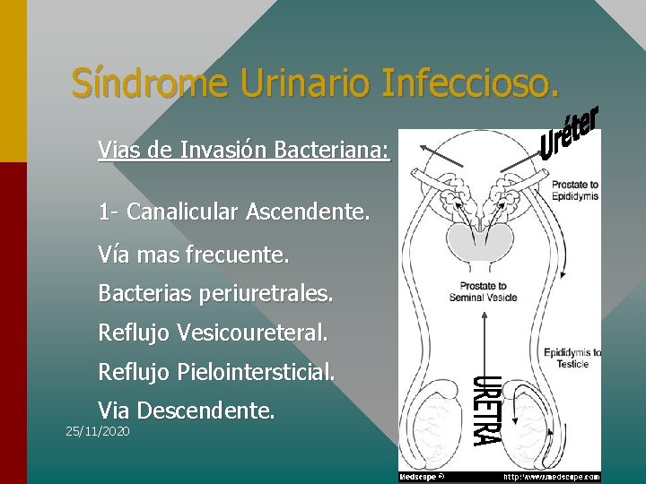 Síndrome Urinario Infeccioso. Vias de Invasión Bacteriana: 1 - Canalicular Ascendente. Vía mas frecuente.