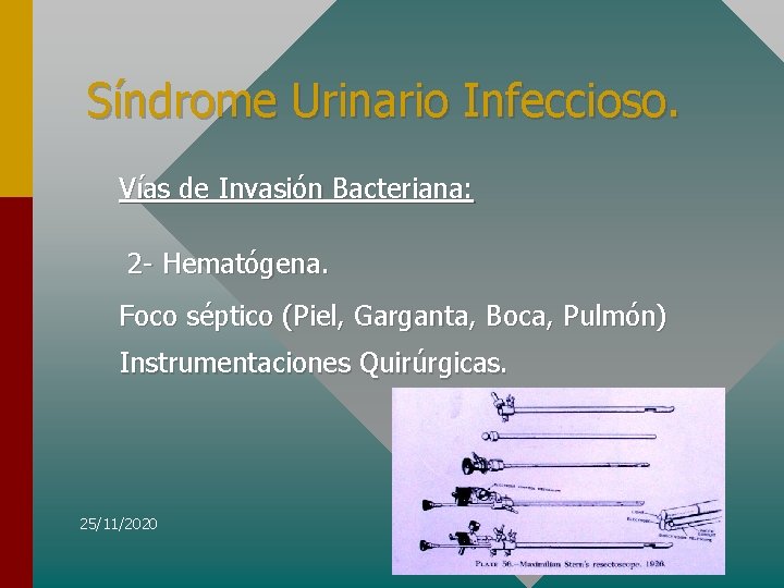 Síndrome Urinario Infeccioso. Vías de Invasión Bacteriana: 2 - Hematógena. Foco séptico (Piel, Garganta,